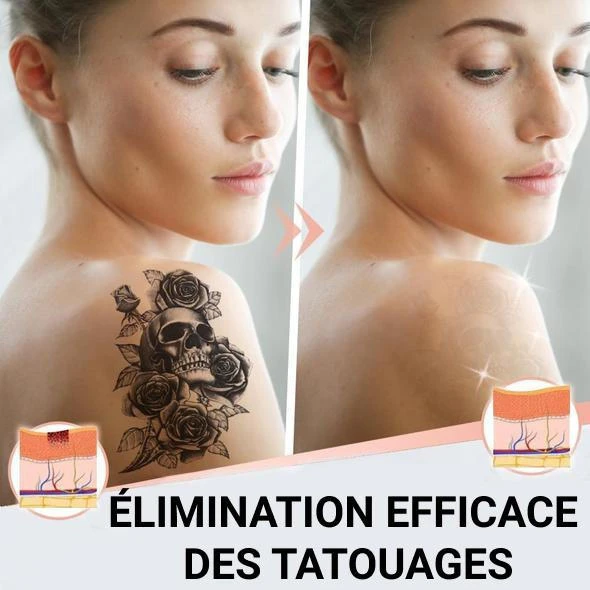 Crème De Detaouage - TatouRemoval™ – Image 2