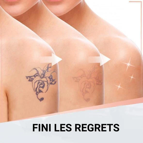 Crème De Detaouage - TatouRemoval™ – Image 4