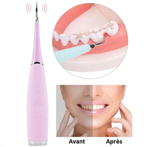 Détartreur Dentaire Professionnel - DentalCare™ – Image 6
