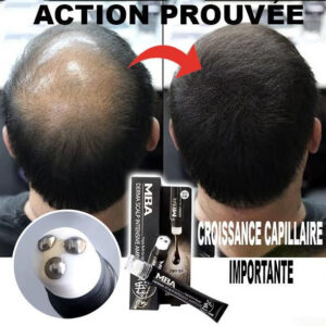 Sérum de repousse des cheveux en Roll-on