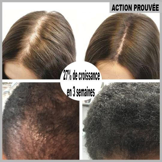 Sérum de repousse des cheveux en Roll-on – Image 2