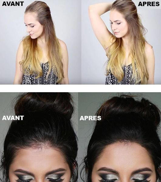 Sérum de repousse des cheveux en Roll-on – Image 8