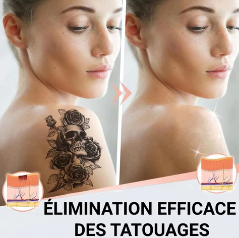 effet visible avant et après détatouage sur un bras
