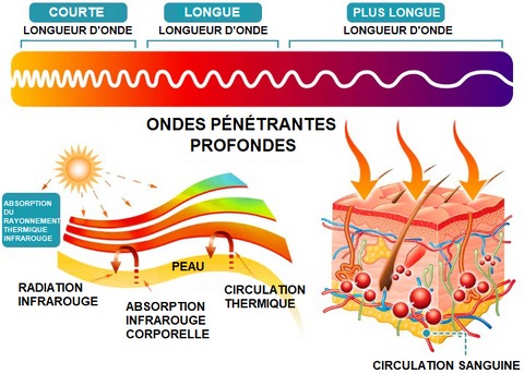 Effet de la thérapie infrarouge lointain sur les tissus