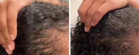 Cheveux brillants et en bonne santé grâce à l'huile