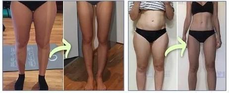 Réglage des niveaux d’intensité sur le masseur EMS