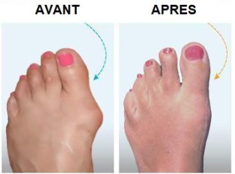 Détail des matériaux et couleurs des sandales plateformes femmes