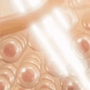 Schéma montrant diminution collagène et acide hyaluronique avec l'âge