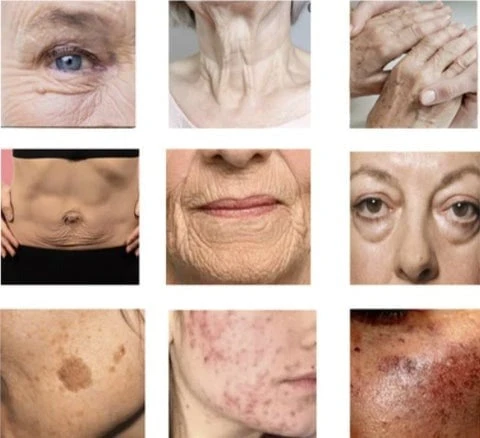Avant-après utilisation du sérum anti-âge au collagène