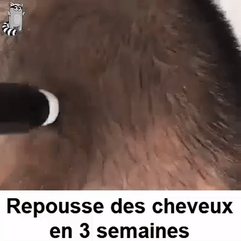 Flacon de sérum capillaire roll-on pour repousse des cheveux