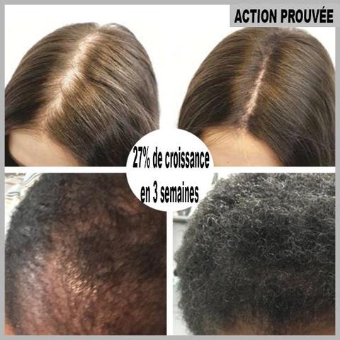 Personnes utilisant le sérum pour cheveux fins et clairsemés