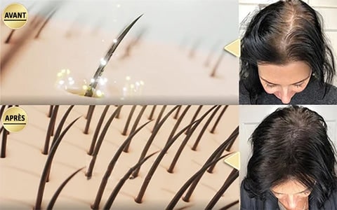 Barre de shampoing au gingembre pour la pousse des cheveux